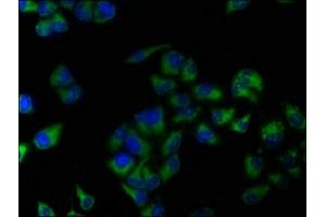 Immunofluorescence staining of Hela cells with ABIN7144538 at 1:133, counter-stained with DAPI.