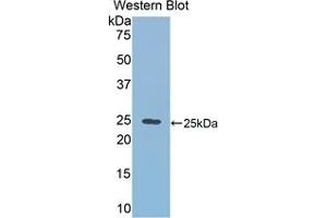 Detection of Recombinant RALBP1, Mouse using Polyclonal Antibody to RalA Binding Protein 1 (RALBP1)