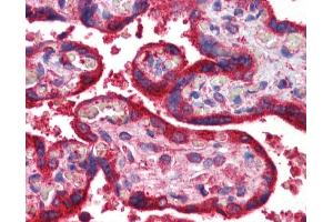 Immunohistochemistry (IHC) image for anti-Wingless-Type MMTV Integration Site Family, Member 3A (WNT3A) (C-Term) antibody (ABIN2787842)