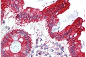 Human Colon (formalin-fixed, paraffin-embedded) stained with UBE2L3 antibody ABIN462238 followed by biotinylated goat anti-rabbit IgG secondary antibody ABIN481713, alkaline phosphatase-streptavidin and chromogen. (UBE2L3 anticorps  (C-Term))