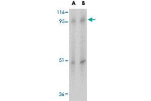 Western blot analysis of SLC39A10 in human spleen tissue lysate with SLC39A10 polyclonal antibody  at (A) 1 and (B) 2 ug/mL . (SLC39A10 anticorps  (Internal Region))
