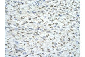 Rabbit Anti-SF3A1 antibody         Paraffin Embedded Tissue:  Human Heart    cell Cellular Data:  cardiac cell    Antibody Concentration:  4. (SF3A1 anticorps  (N-Term))