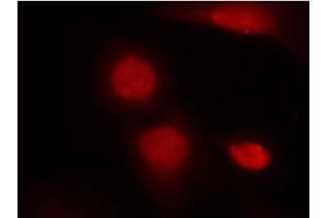 Image no. 1 for anti-Androgen Receptor (AR) (pSer213) antibody (ABIN319225) (Androgen Receptor anticorps  (pSer213))