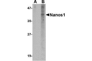 Western Blotting (WB) image for anti-Nanos Homolog 1 (NANOS1) (N-Term) antibody (ABIN1031474) (Nanos Homolog 1 anticorps  (N-Term))