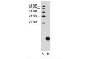 Image no. 1 for anti-Ribosomal Protein S29 (RPS29) (C-Term) antibody (ABIN203394) (RPS29 anticorps  (C-Term))