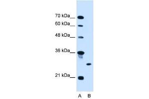 RNF39 antibody used at 2.