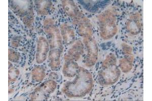 IHC-P analysis of Human Stomach Tissue, with DAB staining. (COL4A1 anticorps  (AA 1444-1669))