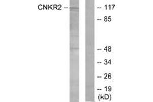Western blot analysis of extracts from Jurkat cells, using CNKR2 Antibody.