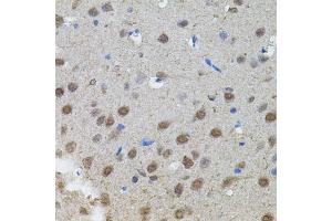 Immunohistochemistry of paraffin-embedded rat brain using MYCN antibody. (MYCN anticorps)