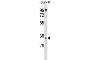 UBXN8 Antibody (N-term) western blot analysis in Jurkat cell line lysates (35 µg/lane).
