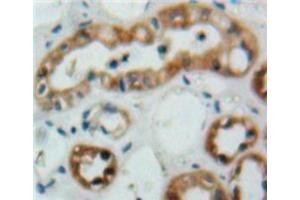 Used in DAB staining on fromalin fixed paraffin-embedded Kidney tissue (CD235a/GYPA anticorps  (AA 20-91))