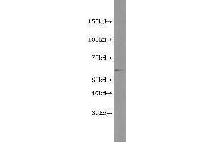 Western Blotting (WB) image for Terminal Complement Complex C5b-9 (C5b-9) ELISA Kit (ABIN1117376) (C5b-9 Kit ELISA)