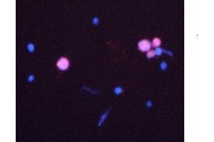 Immunofluorescent Caspase 3 detection in HeLa cells after induction of apoptosis (red fluorescence). (Caspase 3 anticorps  (N-Term))