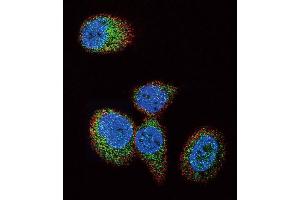 Confocal immunofluorescent analysis of HRAS Antibody (Center) (ABIN392183 and ABIN2841894) with MCF-7 cell followed by Alexa Fluor 488-conjugated goat anti-rabbit lgG (green).