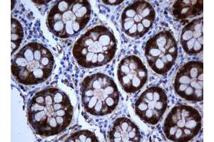 Image no. 5 for anti-Selenium Binding Protein 1 (SELENBP1) antibody (ABIN1500860)