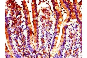 IHC image of ABIN7154765 diluted at 1:300 and staining in paraffin-embedded human small intestine tissue performed on a Leica BondTM system.