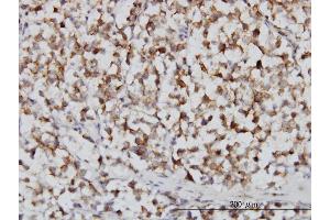 Immunoperoxidase of monoclonal antibody to FH on formalin-fixed paraffin-embedded human seminoma. (FH anticorps  (AA 33-510))