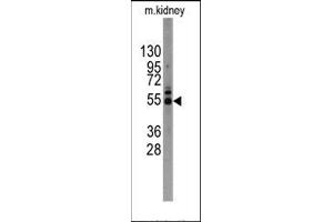 Image no. 1 for anti-Matrix Metallopeptidase 12 (Macrophage Elastase) (MMP12) (C-Term) antibody (ABIN358685)
