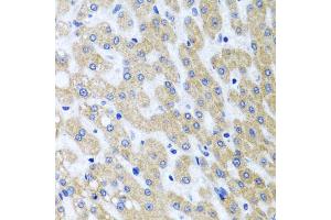 Immunohistochemistry of paraffin-embedded human liver injury using PRMT2 antibody.