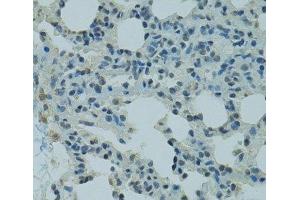Immunohistochemistry of paraffin-embedded Rat lung using PRDM2 Polyclonal Antibody at dilution of 1:100 (40x lens). (PRDM2 anticorps)