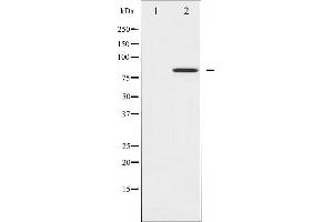 Western blot analysis of STAT4 phosphorylation expression in IL-4 treated HeLa whole cell lysates,The lane on the left is treated with the antigen-specific peptide.