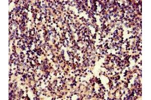 Immunohistochemistry of paraffin-embedded human spleen tissue using ABIN7157042 at dilution of 1:100 (IRF3 anticorps  (AA 1-452))
