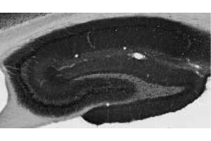 Adult rat hippocampus immunohistochemistry.