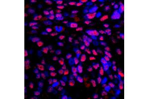 Immunofluorescence (IF) image for anti-Replication Protein A2, 32kDa (RPA2) (C-Term) antibody (ABIN7449012) (RPA2 anticorps  (C-Term))