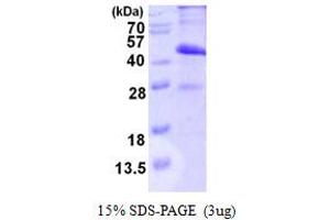 SDS-PAGE (SDS) image for MAD2L1 Binding Protein (MAD2L1BP) (AA 1-274) protein (His tag) (ABIN7279737)
