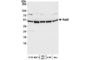 Western Blotting (WB) image for anti-RAD9 Homolog A (S. Pombe) (RAD9A) (C-Term) antibody (ABIN7454682)
