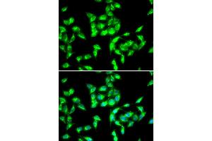 Immunofluorescence analysis of HeLa cells using ANTXR1 antibody (ABIN5973910). (ANTXR1 anticorps)