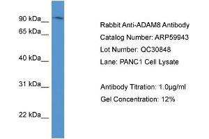 WB Suggested Anti-ADAM8  Antibody Titration: 0. (ADAM8 anticorps  (N-Term))