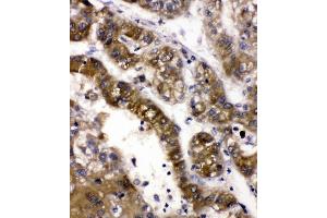 IHC analysis of ADH5 using anti-ADH5 antibody (ABIN4886429). (ADH5 anticorps  (AA 212-374))