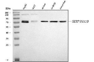 Western blot analysis of SERPINA10 using anti-SERPINA10 antibody (ABIN7599905).