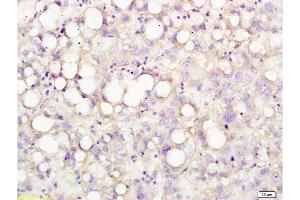 Formalin-fixed and human liver tissue labeled with Anti-USP-1 Polyclonal Antibody, Unconjugated  at 1:200 followed by conjugation to the secondary antibody and DAB staining (USP1 anticorps  (AA 701-785))