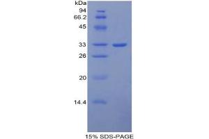 SDS-PAGE analysis of Mouse ITIH1 Protein. (ITIH1 Protéine)