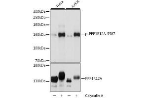 Western blot analysis of extracts of various cell lines, using Phospho-PPP1R12A-S507 antibody (ABIN6135287, ABIN6136196, ABIN6136197 and ABIN6225664) at 1:2000 dilution or PPP1R12A antibody (ABIN6128260, ABIN6146059, ABIN6146061 and ABIN6213896).
