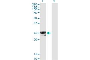 Western Blot analysis of NOG expression in transfected 293T cell line by NOG monoclonal antibody (M11), clone 2C10. (NOG anticorps  (AA 27-145))