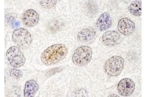 Immunohistochemistry (IHC) image for anti-GATA Zinc Finger Domain Containing 2B (GATAD2B) (AA 50-100) antibody (ABIN7448709) (GATAD2B anticorps  (AA 50-100))