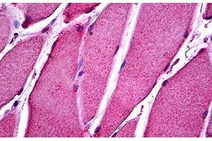 Human Skeletal Muscle: Formalin-Fixed, Paraffin-Embedded (FFPE)