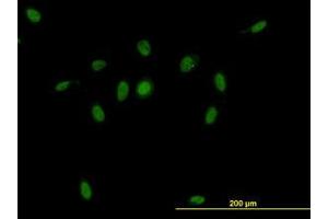 Image no. 1 for anti-CSE1 Chromosome Segregation 1-Like (CSE1L) (AA 872-972) antibody (ABIN465991) (Exportin 2 anticorps  (AA 872-972))