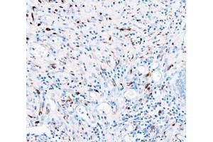 IHC analysis of CD68 using anti-CD68 antibody (ABIN7600142). (CD68 anticorps  (AA 154-354))