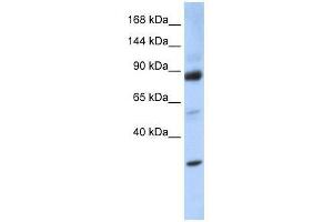 ZHX3 antibody used at 0. (ZHX3 anticorps  (Middle Region))