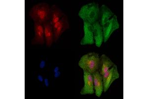 ABIN6262790 and ABIN6278915 staining  cells by IF/ICC.