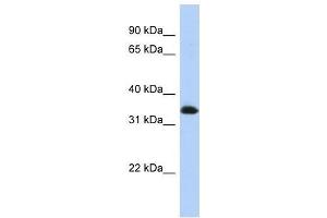 ZNF511 antibody used at 0. (ZNF511 anticorps  (N-Term))