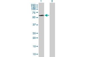 Western Blot analysis of STIP1 expression in transfected 293T cell line by STIP1 MaxPab polyclonal antibody.