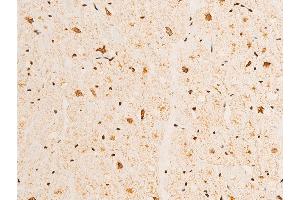 ABIN6267232 at 1/100 staining human heart tissue sections by IHC-P.