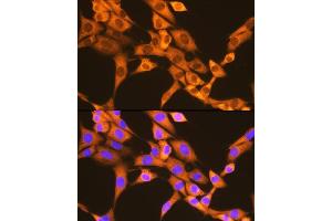 Immunofluorescence analysis of NIH-3T3 cells using F/UBD Rabbit mAb (ABIN7271134) at dilution of 1:100 (40x lens). (UBD anticorps)