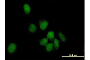 Immunofluorescence of purified MaxPab antibody to POLK on HeLa cell. (POLK anticorps  (AA 1-472))