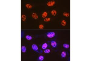 Immunofluorescence analysis of NIH-3T3 cells using 53BP1 Rabbit mAb (ABIN1679832, ABIN3018199, ABIN3018200 and ABIN7101582) at dilution of 1:100 (40x lens).
